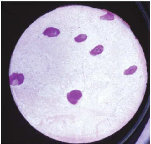 Fig. 3. Disc with salivary dro- dro-plets treated with periodic  acid and Schiff´s reagent,  re-presenting gland density