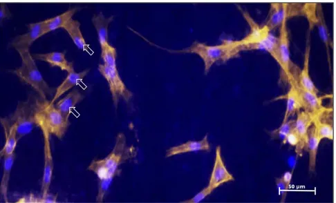 Figure  5. Fluorescence image  of human umbilical cord perivascular cells ad- ad-hered  onto  a  metal  surface