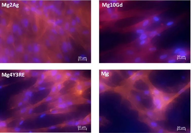 Fig 7. Confocal fluorescence microscopy of focal adhesion and actin cytoskeleton in HUCPV cells cultured for 24 h on Mg2Ag, Mg10Gd, Mg4Y3RE and Mg on 48 h pre-incubated