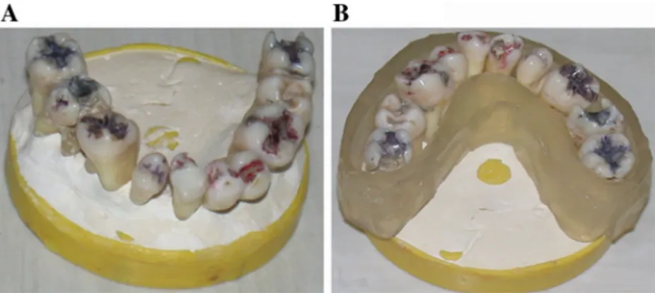 Fig. 1 Prepared model cast. a A labial view of the mounted teeth. b A palatal view of the teeth with Monet Clearbite2 impression material serving as a replacement for soft tissues