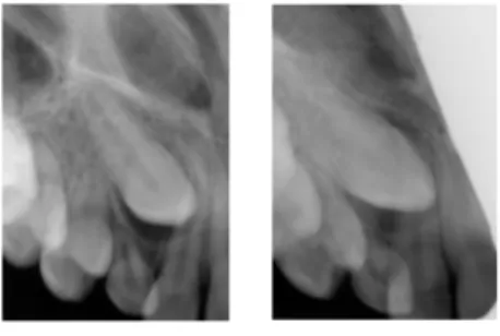 Figure 3. An example showing the radiographs presented in the survey for  one (case 8) of the 12 patient cases.
