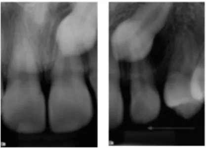 Figure 4. An example showing the radiographs presented in the survey for  one (case 10) of the 12 patient cases.