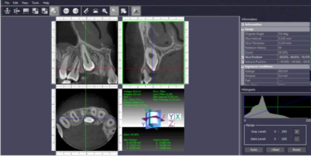 Figure 5.  Image of the viewer program for the CBCT images (i-Dixel One  Data Viewer Plus software, J