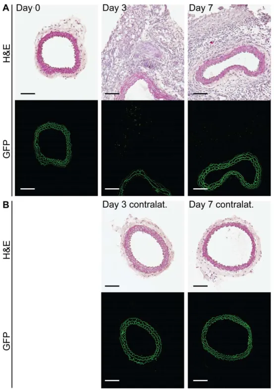 Figure 3. Regulatory T cells do not accumulate in the injured artery but are observed in the periadventitial tissue after surgery