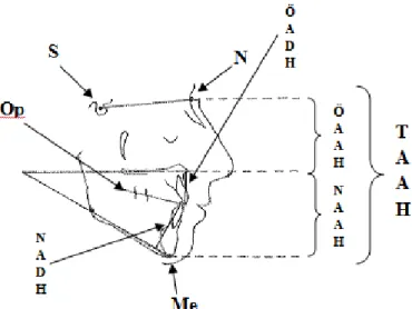 Fig 1. Bilden visar sella turcica (S), nasion (N),  menton  (Me)  ocklusionsplanet  (Op)