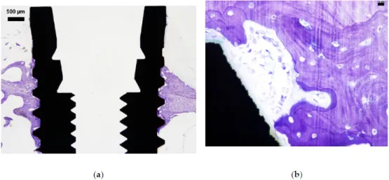 Figure 5. (a) A typical example of a control sample (no ligature involved) with darker stained  periosteal and endosteal new bone formation