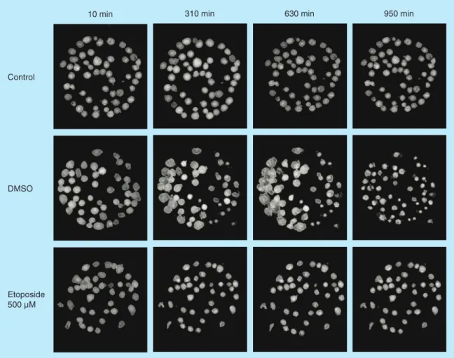 Figure 2. Hologram images of Jurkat cells captured on antibody Lewis X Clone-1. The images are showing control,  DMSO and etoposide-treated cells at four different timepoints: 10, 310, 630 and 950 min