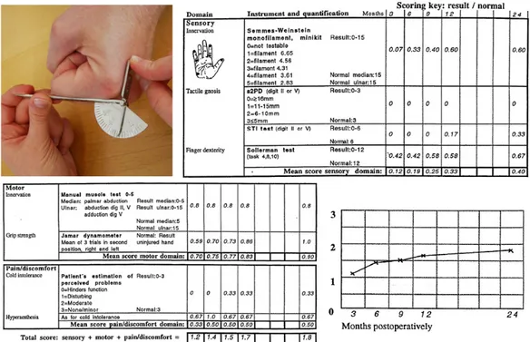 Figure 2   -  A ‘Native Artefact’. One example out of many:  A goniometer– used to measure the degree of flexibility in  the joints