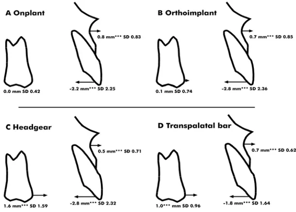 Figure 8a-d. Maxillary dental and skeletal changes (in mm) and  standard deviations (SD) contributing to alterations in the four  groups during the space closure phase