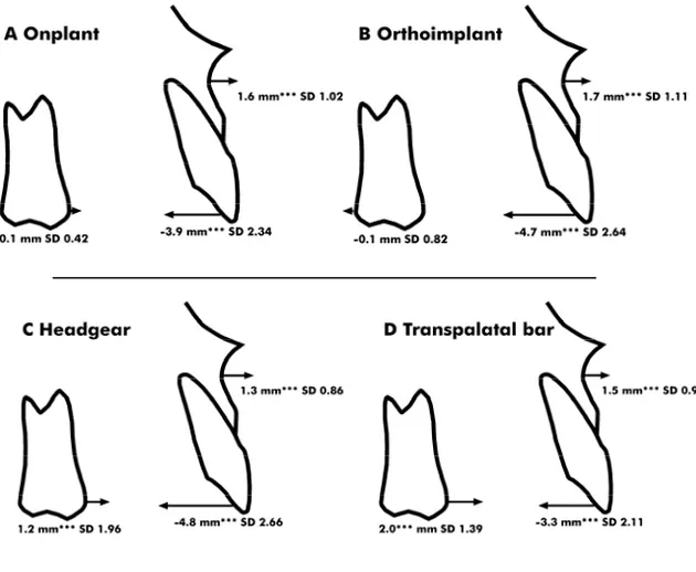 Figure 10a-d. Maxillary dental and skeletal changes (in mm) and  standard deviations (SD) contributing to alterations in the four  groups during the total observation period