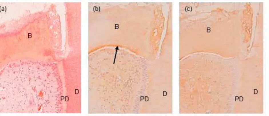 Figure 5 Micrographs of a tooth from subject no. 4a who twelve  weeks earlier had received a partial pulpotomy and been treated  with calcium hydroxide