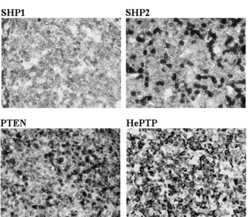 FIGURE 1 The expression of SHP1, SHP2, PTEN, and HePTP in pediatric tonsil control tissue