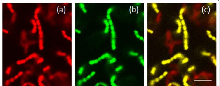 Figure 1 16S rRNA fluorescence in situ hybridization images of S. sanguinis and A. naeslundii in mono- and dual-species biofilms
