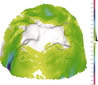 Figure 3: Distance analysis with true values showing an un- un-changed area (white coloured) in the centre of the palatal vault.