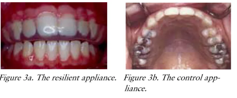 Figure 3a. The resilient appliance.   Figure 3b. The control app-                                                          liance