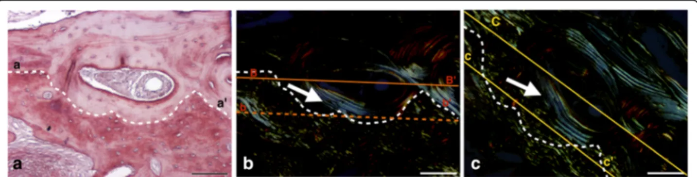 Fig. 4 Histomicrograph of a biopsy from the BC group, showing an aspect of newly formed bone