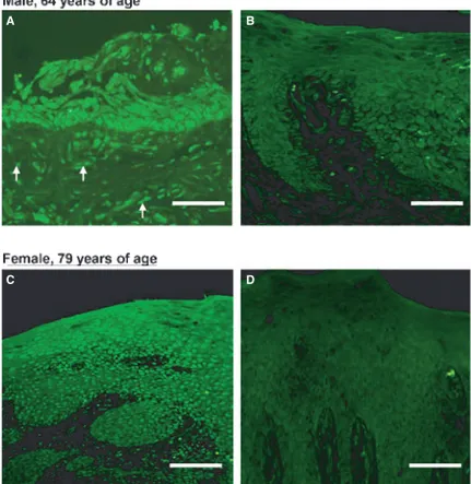 Fig. 1. Nuclear estrogen receptor (ER) b but not nuclear ERa immunoreactivity is shown in epithelial cells of healthy gingival tissues from a male subject, 64 years of age (A and B), and a female subject, 79 years of age (C and D)