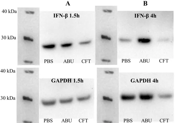 Figure 3. Western blot. Proteins were extracted from the lysate of A498 cells exposed to CFT073  (CFT)  or  E