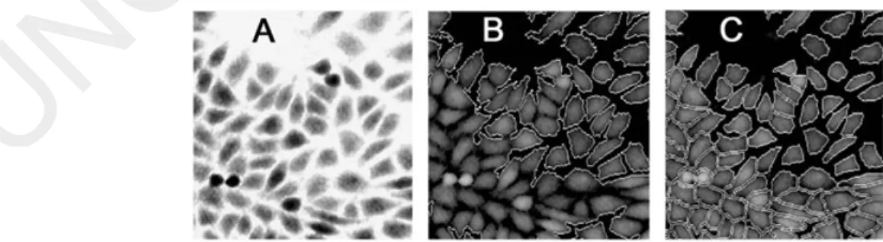 Fig. 2. Cells were captured by digital holography. After computer reconstruction the images were segmented in order to perform a cell count