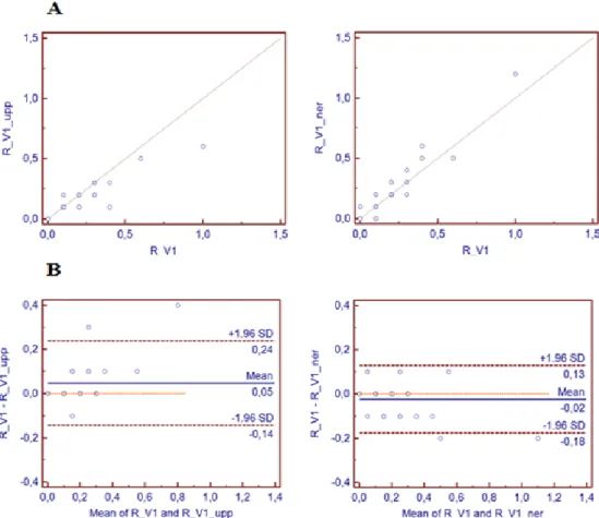 Figur 3A och 3B. Jämförelse av amplituder mellan rätt och felaktig placering av bröstelektroderna,  i ”spridningsdiagram” (A) och ”Bland Altman-diagram” (B) för R-vågen i avledning V1