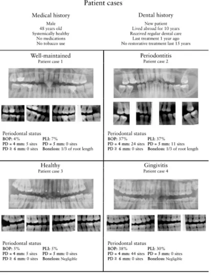 Figure 3. Patient history, periodontal status, panoramic and  bitewing images of each patient case. BOP: number of sites (ex‐
