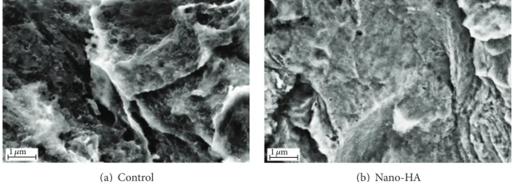 Figure 2: SEM images taken at ×40 000 magnification on (a) the control surface and (b) the nano-HA surface.