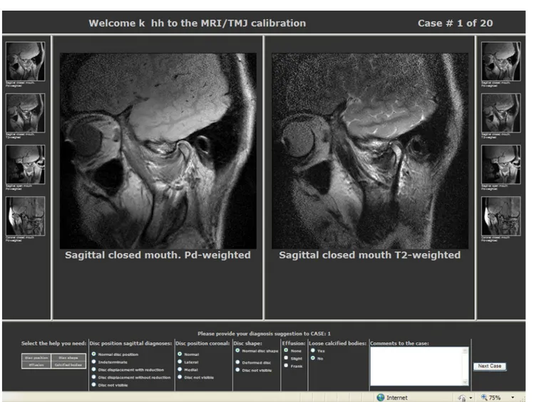 Figure 1 Page on the internet showing, in the left and right columns, MR images of the temporomandibular joint (TMJ) in the closed mouth position [proton density (PD) and T 2 ], open mouth position (PD) and coronal view (PD)