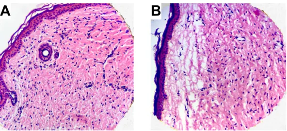 Figure 5. Excised pig skin membrane soaked in 10 mM NaN 3  and 1 mM H 2 O 2  for 5 h without (A) and  with (B) exposure to UVB irradiation (dosage corresponding to 180 J/cm 2 )