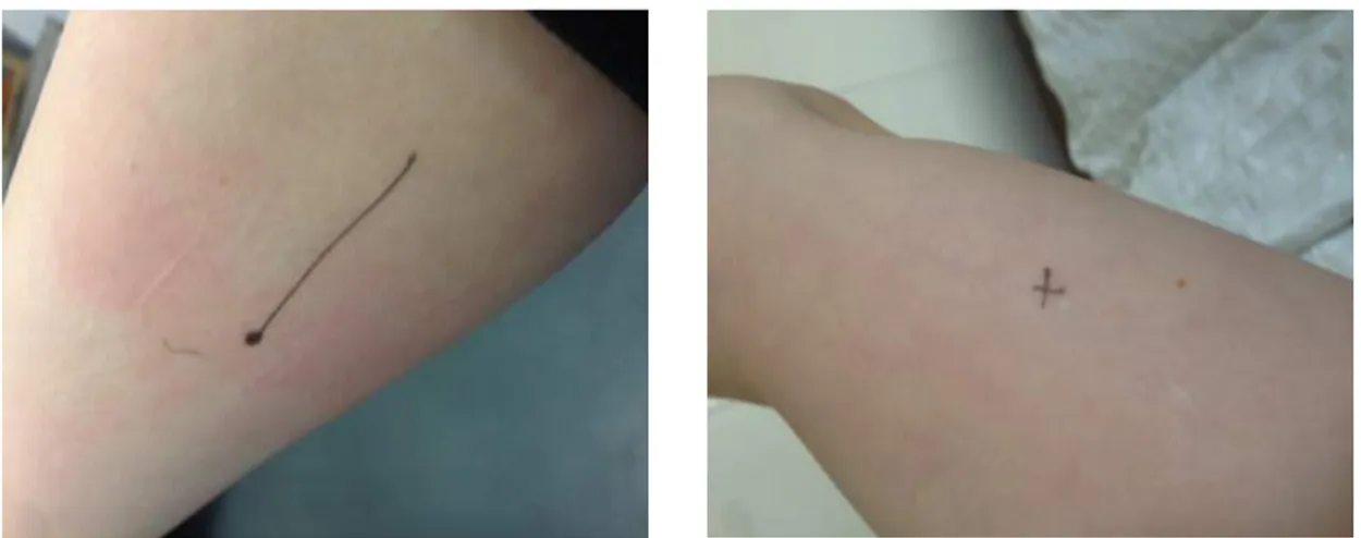 Figure	3	and	4.	Pen	marks	on	my	arm	made	by	participants 