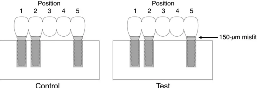 Fig. 1. The test and control arrangement of the implant-supported prosthesis.