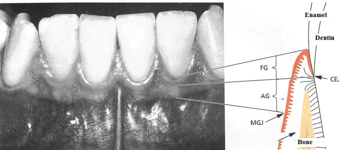 Figure 2. Description of anatomical structures seen in periodontium.  FG= Free gingiva, AG=, Attached  ginigiva, MGJ=Muco-Gingivial-Junction, CEJ=Cemento-Enamel-Junction