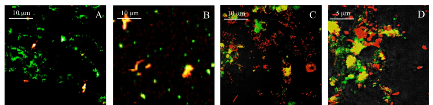 Figur 11. Bilder tagna i ett konfokalmikroskop. Prover från subgingivala patologiska fickor kring implantat (A och B)  som behandlats med FITC-casein och färgats in med FISH