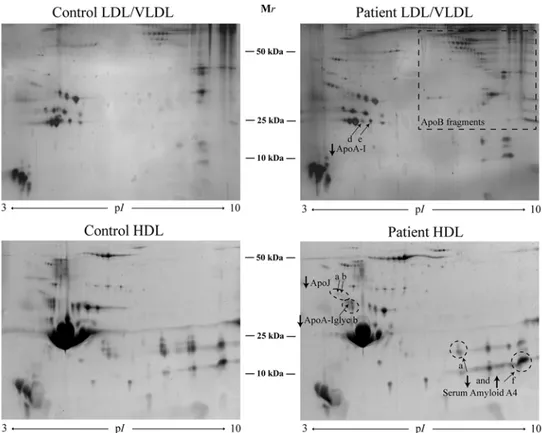 Figure 2. 2-DE pattern of LDL/VLDL and HDL proteins from controls and patients