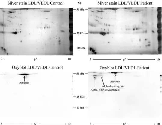 Figure 3. The carbonylation pattern was evaluated by Oxyblot of two 2D gels of LDL/VLDL isolated from one patient with periodontitis and one control