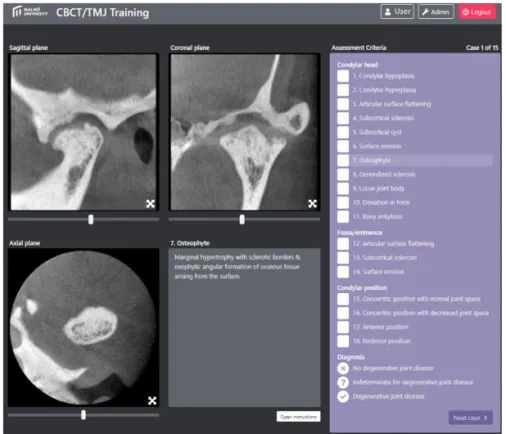 Figure 5. A screenshot of the web-based programme that developed in  Study II for the interpretation of CBCT images of the TMJ