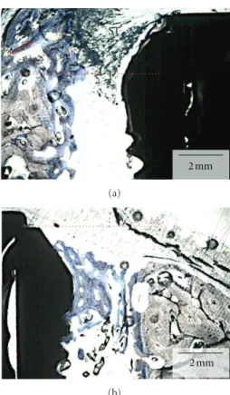 Figure 4: Merged optical micrograph depicting the experimental group, where the immediate implant placed at the mesial molar socket was covered with a resorbable membrane prior to suturing.