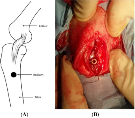Figure 9. Illustration of implant location (A) and exposed surgical site with implant in position (B)
