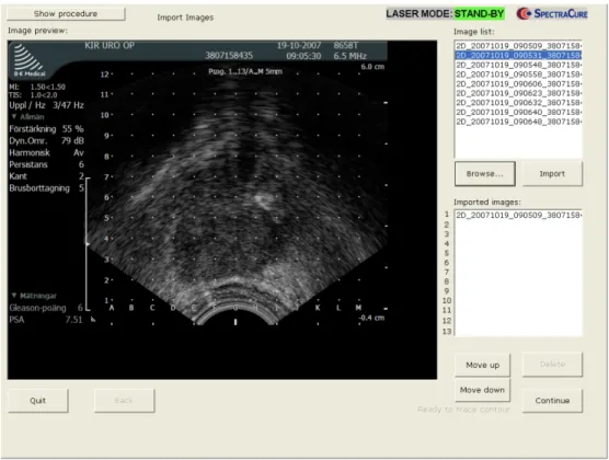 Figure 5. Screenshot of a step in the SpectraCure System (Screenshot. SpectraCure, 2017)