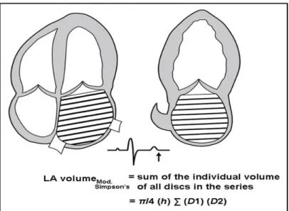 Figur 1. Mätning av vänster förmak (LA) volym från Simpson-biplan metod som använder apikala  4- och 2-kammarsvyer vid ventrikulär slutsystole (maximal VF storlek)