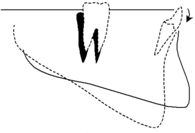 Figure 6. Posterior rotation of the mandible. 