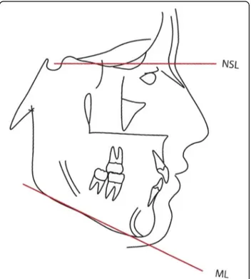 Fig. 1 Cephalometric analysis. Landmarks and reference lines used for angular measurements in the lateral cephalograms, NSL nasion-sella line, ML mandibular line.