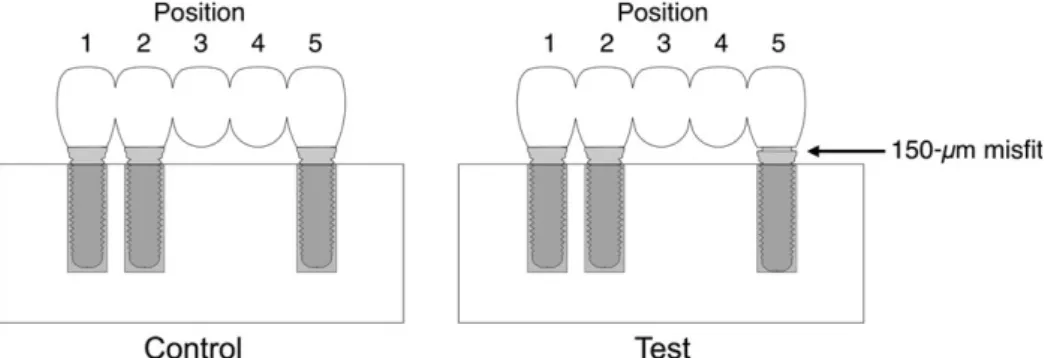 Fig. 1. The test and control arrangement of the implant-supported prosthesis.