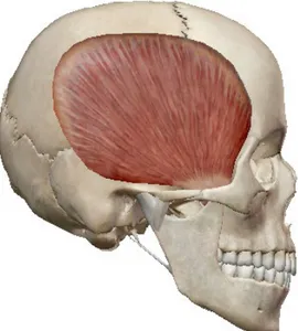 Figur 2. The temporal muscle. It originates from the lateral surface of the skull and the temporal fossa and attaches on the  coronoid process