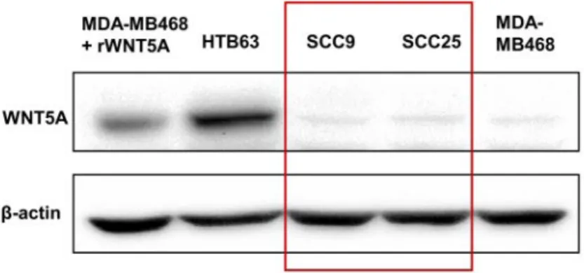 Figure 7. Loss of WNT5A protein expression in OSCC cells, SCC9 and  SCC25.