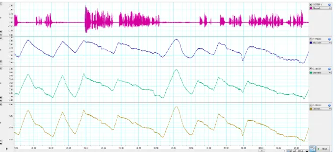 Fig.  3.  Example  of  recording  for  one  speaker  in  LabChart.  The  first  channel  depicts  sound,  the  second  records expansion of the rib cage, the third level measures the same for the abdomen