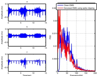Figure 8. (a) Contaminated EMG, (b) denoised EMG and (c) estimated noise using spike clipping  and (d) PSD of clean EMG and denoised EMG using spike clipping