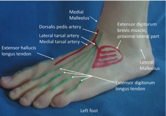 Fig. 1. anatomical landmarks on the dorsum of the left foot showing surface anatomy of eDB muscle.