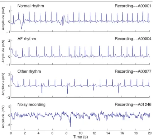 Figure 2.2: Examples of recordings from the dataset [27]. 