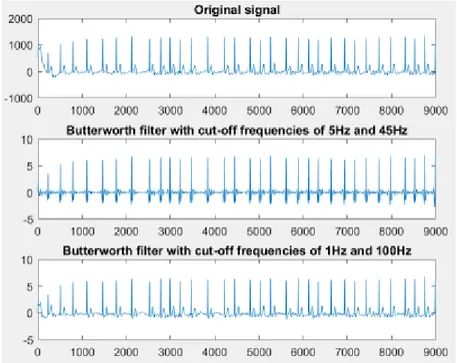Figure 3.1: AF signal after filtering with two Butterworth filters. 