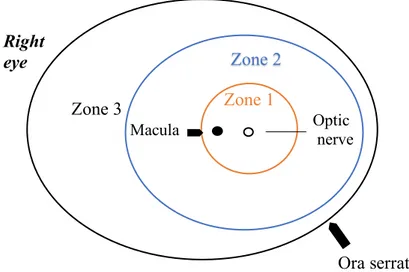 Figure  2:  ROP  is  classified  into  three  retinal  zones  where  the  disease  may  occur
